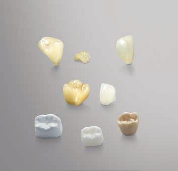 5 CEREC MC Full-contour single-tooth restoration up to 20 mm block size Precise Cost-effective solution CEREC MC X Entire range of chairside indications with up to 40 mm block size, incl.