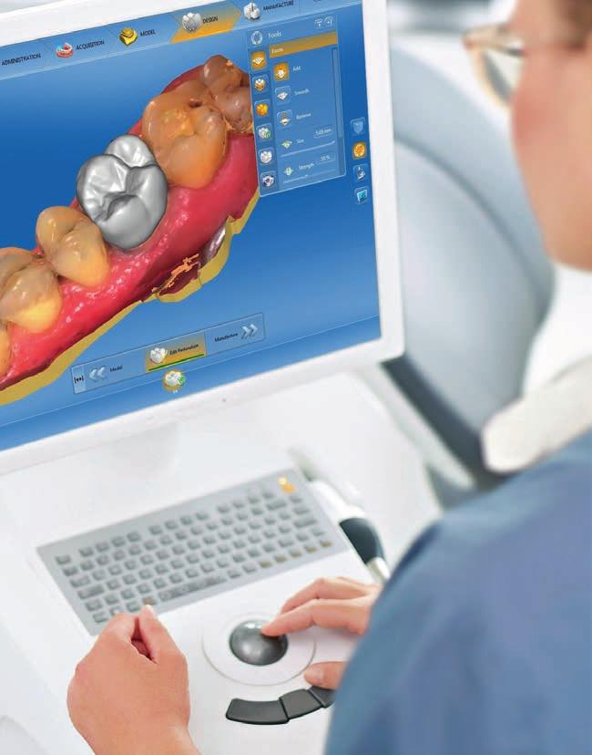 1 04 I 05 2 The CEREC workflow Final restorations in a single visit! 1 Scanning Spare your patients the discomfort of a conventional impression tray.
