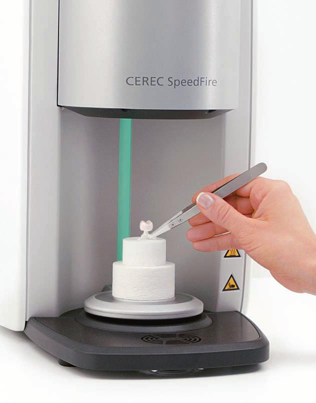 3 Grinding/Milling The CEREC grinding and milling unit and CEREC Software are optimally synchronized with one another.