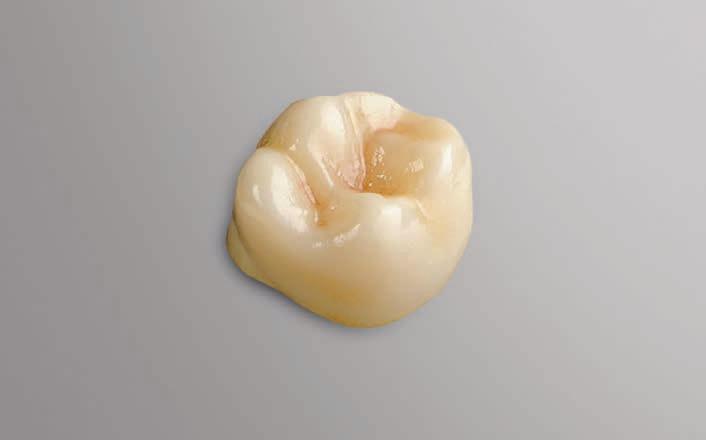 Simple operation with a newly designed user interface of the CEREC Software Unrivalled grinding speed for glass ceramics NEW Open Scan Export 2 Implantology Chairside