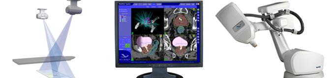 4D Localization Techniques for Prostate Treatment Orthogonal X-rayX images with
