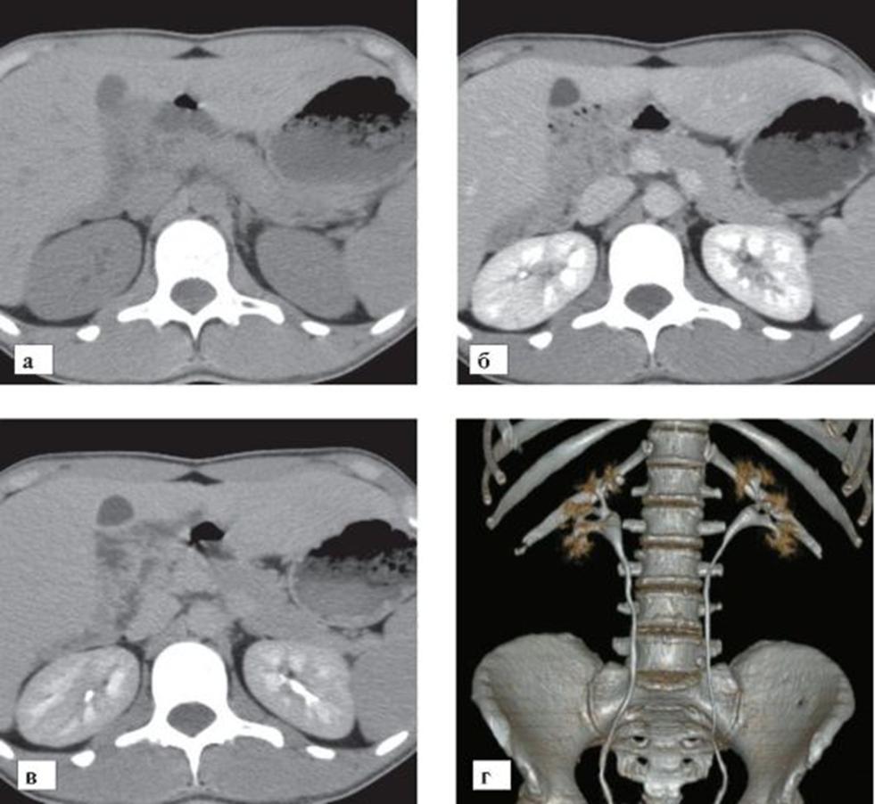 Abdominal CT scanning (with/without contrast media) is used in the evaluation of trauma victims for visceral injury and in the
