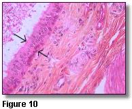 Figure 10 (from slide #48 of your collection) shows an excretory duct of the submandibular gland, with a layer of tall cells resting on a layer of cuboidal cells.
