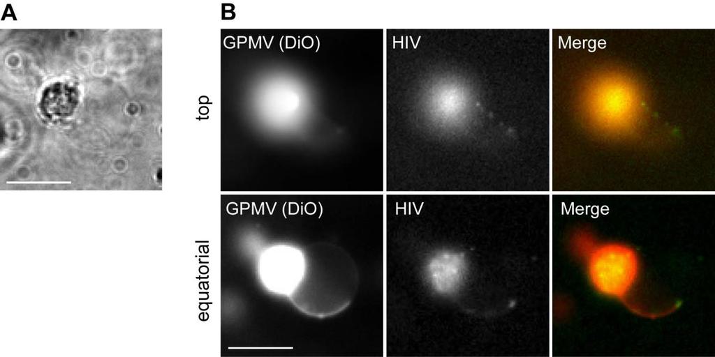 fig. S4. HIV Env pseudovirus particles bind preferentially at boundaries between coexisting Lo and Ld domains in GPMVs. (A) A cell-attached GPMV visualized by bright-field microscopy.