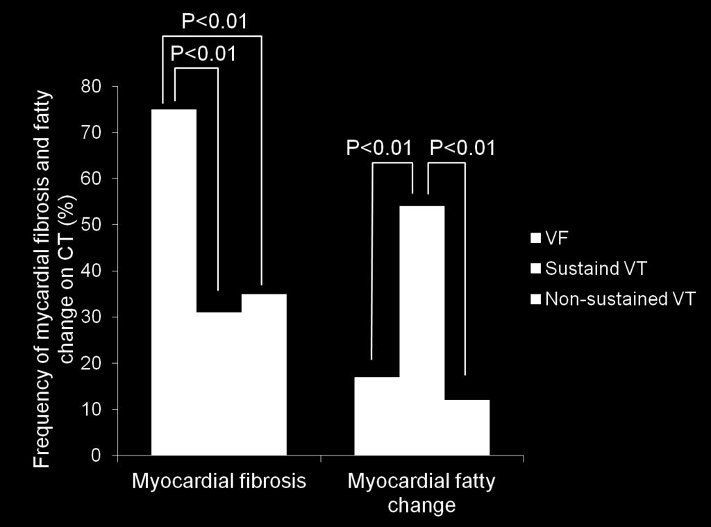 Results & Conclusion Comparison of frequency of myocardial fibrosis and fatty change on 320 slice CT among the 3 non ischemic arrhythmia Groups.