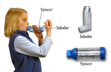Spacers Spacers can be used as an attachment to the inhaler.