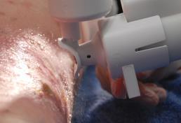 of Non-Contact Ultrasonic Wound