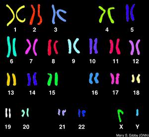 Chromosomal abnormality 1.