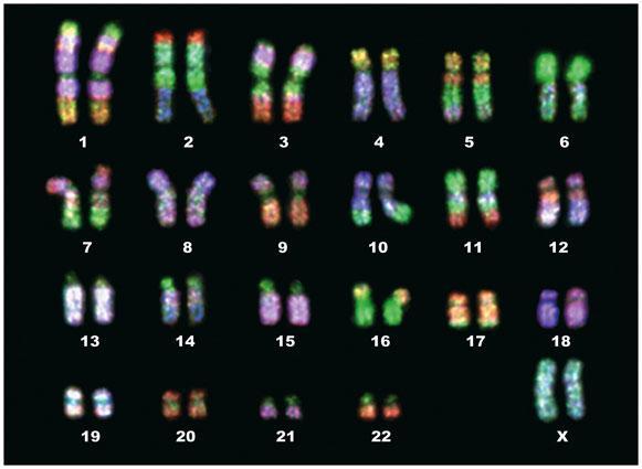 b. Karyotypes- picture of all chromosomes in a