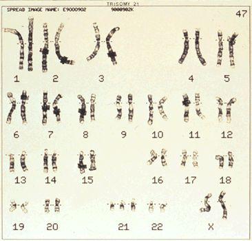 2). Used to identify certain genetic disorders in which