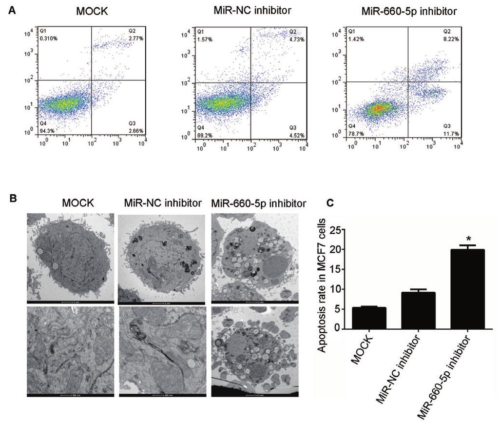 mir-660-5p in human breast cancer 7 cells, the inhibition of mir-660-5p markedly reduced the invasion of MCF7 cells (Figure 5B).