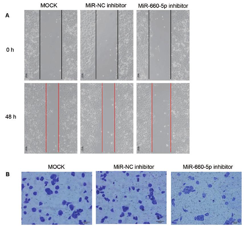 Effect of mir-660-5p downregulation on the apoptosis of MCF7 cells transfected with mir-660-5p inhibitor or control mirna inhibitor was measured by flow cytometry and visualized using an electron
