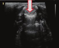 ultrasonography in the axial plane at the level