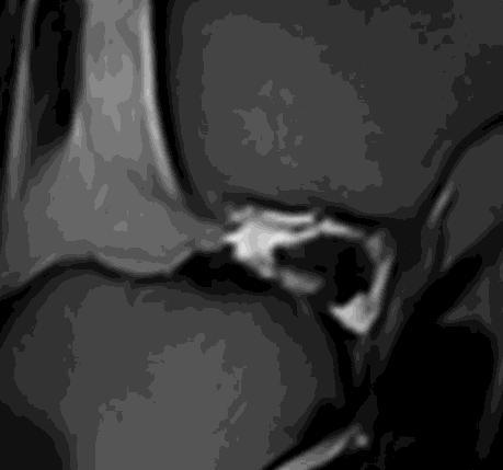 Results MRI based A-Copy Cranial