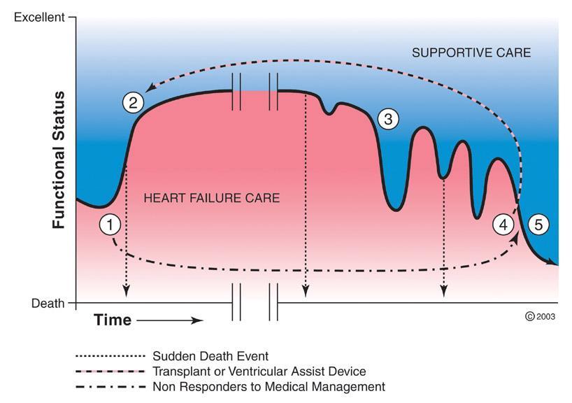 Natural History of HF ONSET SUDDEN DEATH DECOMPENSATIONS