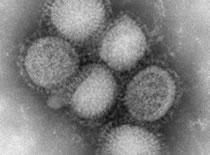 2009 H1N1 Flu Defined What is 2009 H1N1 (swine flu)? 2009 H1N1 (sometimes called swine flu ) is a new influenza virus causing illness in people.