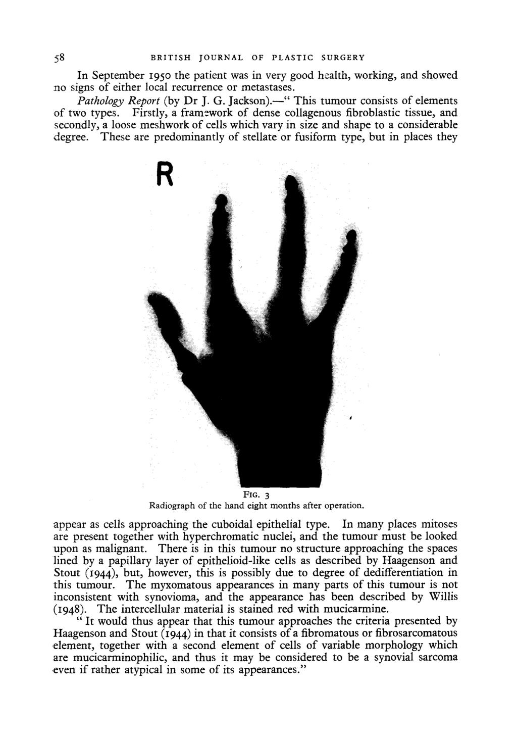 58 BRITISH JOURNAL OF PLASTIC SURGERY In September 195 the patient was in very good health, working, and showed no signs of either local recurrence or metastases. Pathology Report (by Dr J. G.