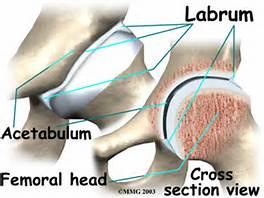The Hip Joint Cartilage Cartilage is critical in understanding arthritis The Hip Joint Cartilage Transmits applied loads across mobile surfaces Lines the ends of bones Surfaces roll or slide during