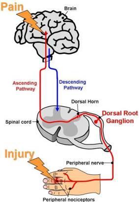 central sensitization inadequate pain control Peripheral