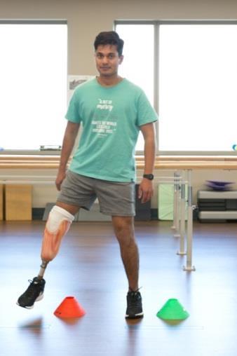 Stationary balance with prosthetic leg Stand near