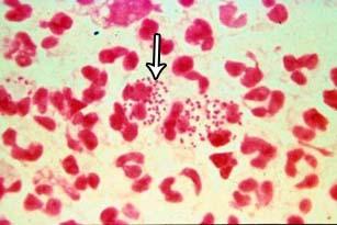 Gram stain Diagnostic tests Microscopy of the vaginal/