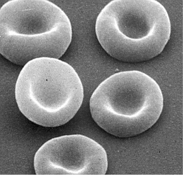 Erythrocytes: These are rounded biconcave disks, bright red in color due to the presence of hemoglobin.