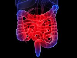 Chronic abdominal pelvic pain of relapsing pattern associated with bowel dysfunction, bloating, disturbed bowel habit in the form of diarrhoea, constipation or both Associated with 50-80% of patients