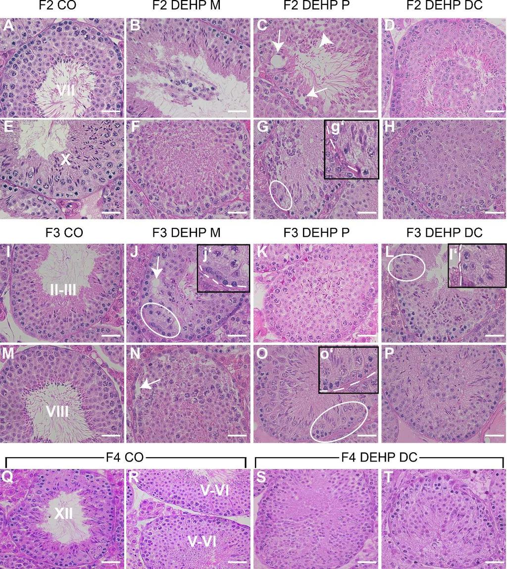 TRANSGENERATIONAL EFFECTS OF PHTHALATE ON MALE GERM CELLS FIG. 4. Testicular cross sections from F2, F3, and F4 offspring at P120.