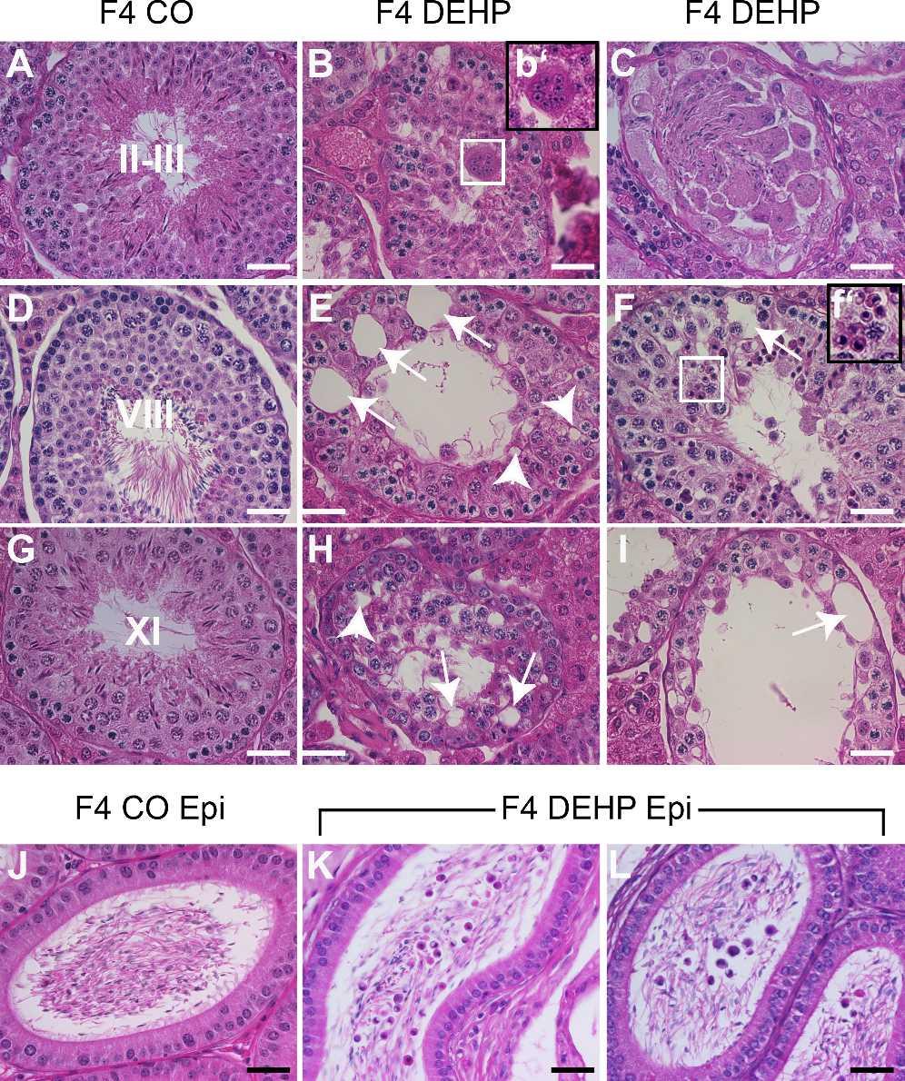 DOYLE ET AL. FIG. 5. Testicular and epididymal cross sections from F4 offspring at P360.