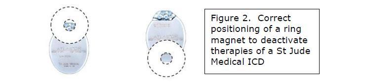 For the purposes of this document, a magnet refers to a specifically designed ring or block magnet, which should be available in all hospitals.