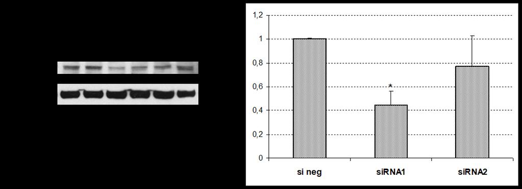 We silenced the expression of the HNF1B gene using two different sirnas (Figure 1).