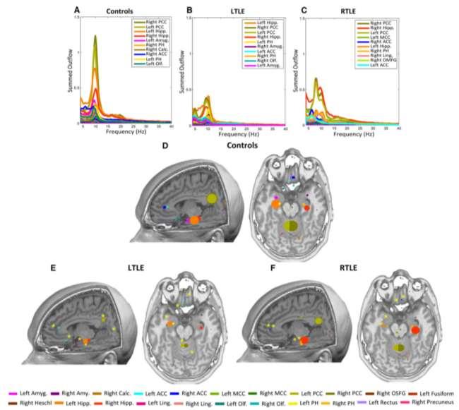 Functional connectivity analysis in epilepsy Coito et al.