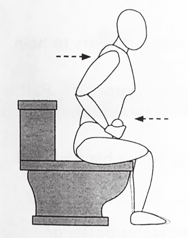 Techniques to Aid Bladder Emptying CREDES MANEUVERER Once finished urinating, make a fist and place above your pubic bone.