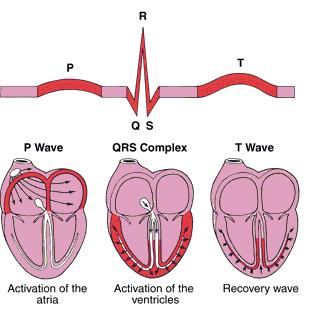 ECG (Electrocardiogram) 3 distinct waves are produced during cardiac cycle P wave caused by arterial depolarization QRS complex caused by
