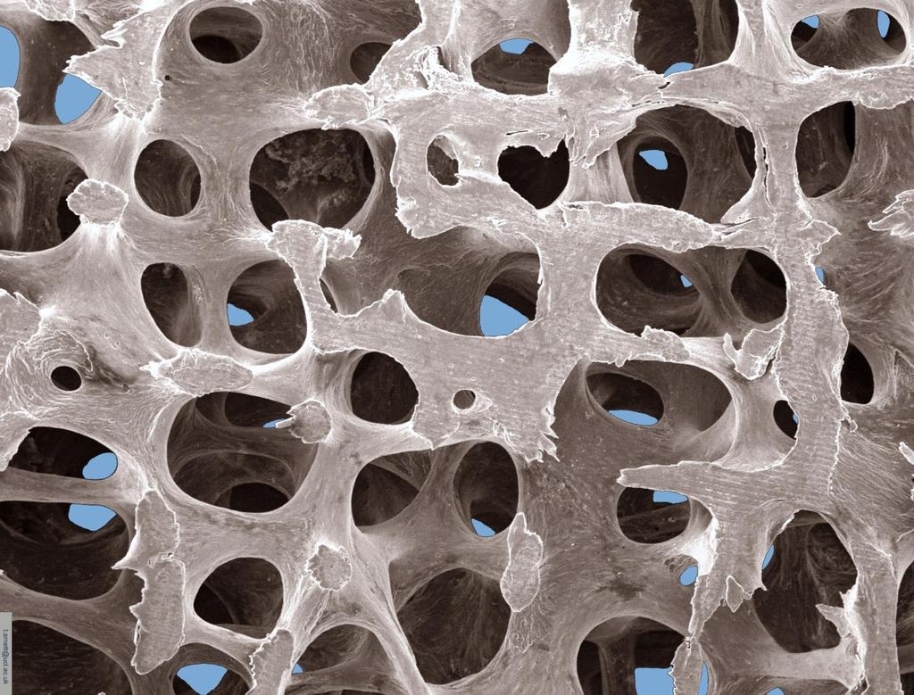 Low-power scanning electron microscope image of normal bone architecture
