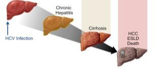 Progression is variable Patients with advanced fibrosis / cirrhosis Urgency to treat Highest risk of mortality /