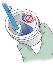 3.1 Manchester Cytology Centre PREPARING A SUREPATH LBC SAMPLE IMPORTANT NOTICE If the broom head is not present in the vial the sample will be reported as inadequate COLLECT an adequate sample from