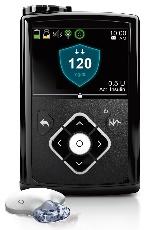Medtronic 670G Artificial Pancreas The 670G is a Hybrid Closed Loop (HCL) system running a modified PID algorithm.