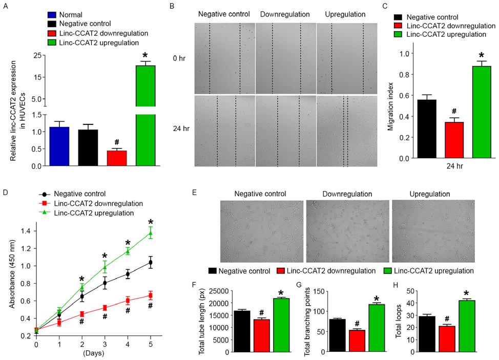 794 lang et al: Glioma promote angiogenesis Figure 7. linc-ccat2 regulates HUVEC migration, proliferation, and tube formation in vitro.