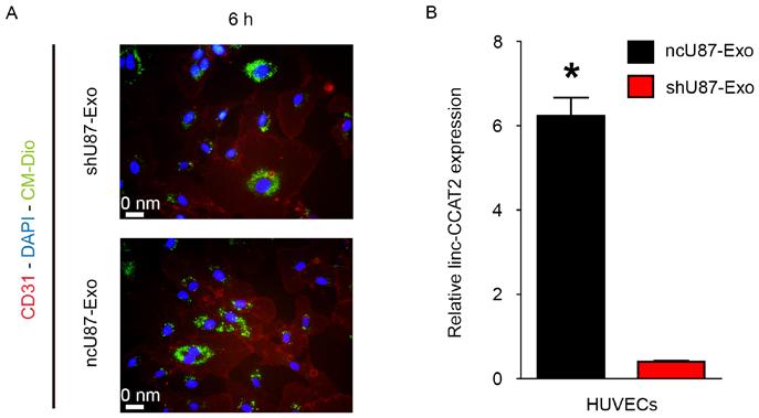 790 lang et al: Glioma promote angiogenesis Figure 2. ncu87-exo and shu87-exo are internalized by HUVECs.