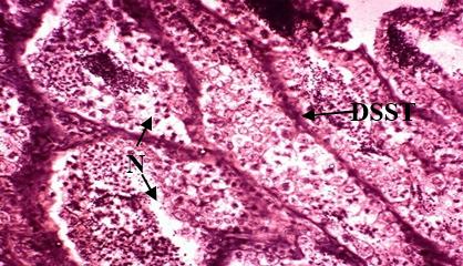 5: Testis of fish exposed to 18 mg/l Lead nitrate for 30 days showing
