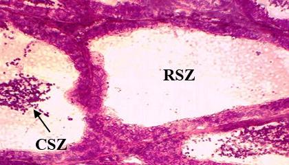 (DSST) and centralization of spermatozoa (CSZ) X 400 Fig.