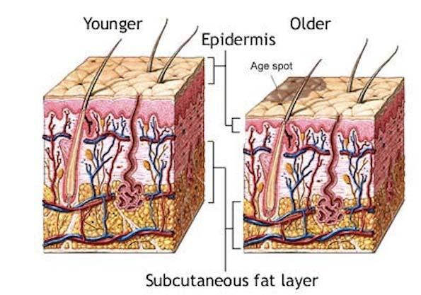 Age-Related Changes in Skin Aging Epidermis thickness Fat layer Density of sweat glands Loss of elastin and collagen fibers Thickening the remained collagen fiber DFU risk Reduction in resilience to