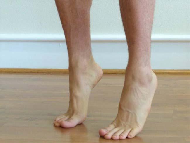 Age-Related Changes in Foot Strength Aging Reduced muscle mass (size and number of