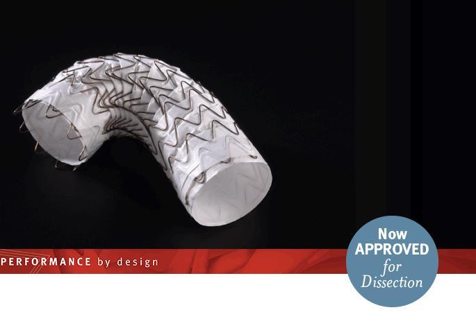 Conformable GORE TAG Thoracic Endoprosthesis 2013 first and only thoracic stent graft approved in US