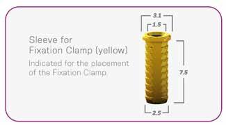 5 In order to ensure stability, the Fixation Clamp should be placed in an area with a sufficient and adequate bone quality.