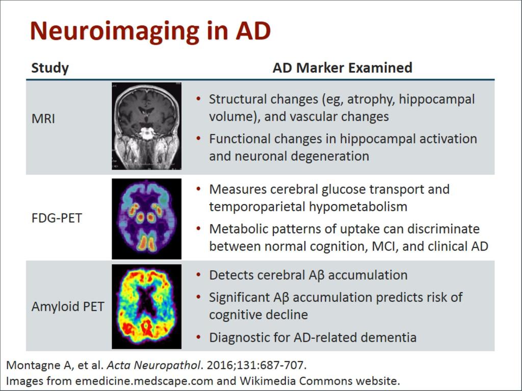 Neuroimaging in AD Montagne A, et al. Acta Neurpathol.