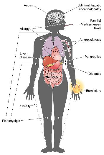 Microbiome Dysbiosis and Disease Irritable Bowel Syndrome (IBS) Inflammatory Bowel Disease (IBD) Colon cancer Obesity Diabetes