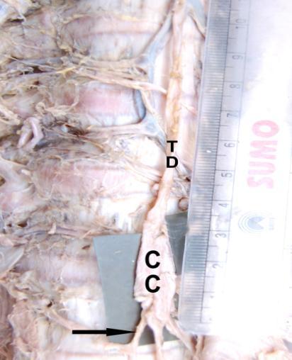 TD-thoracic duct.