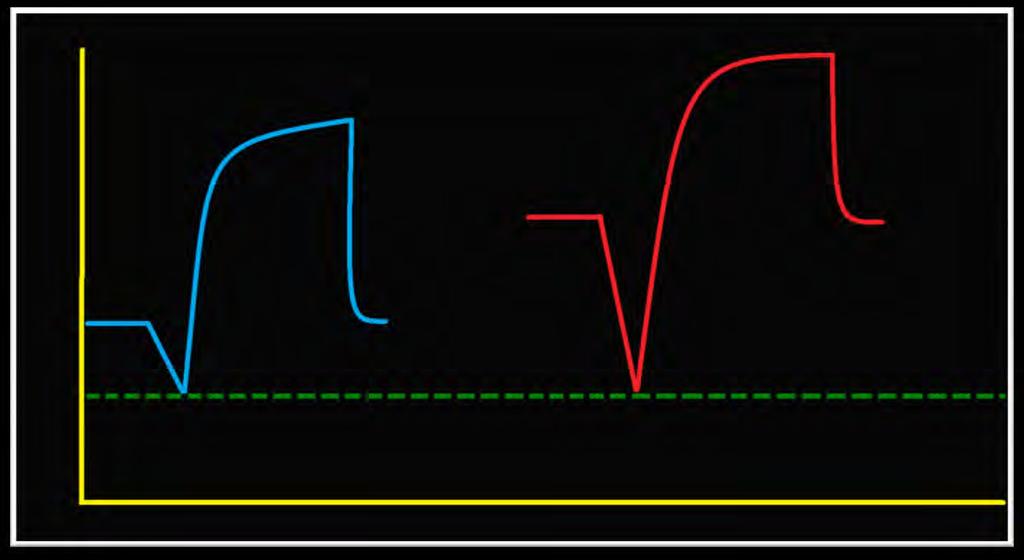 Trigger Dysynchrony Correcting ineffective efforts Ineffective efforts often come in the presence of unintentional PEEP or auto-peep because the ventilator does